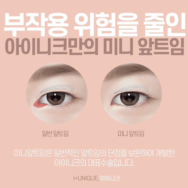 듀얼트임, 듀얼트임가격 한 번에 상담받기! 관련 이미지 3