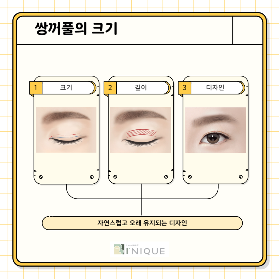 눈성형전후 확실한 변화를 원한다면 관련 이미지 3