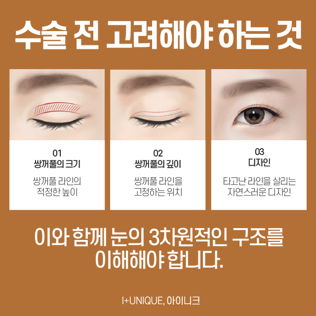 20대눈성형 자연스러움이 최고 관련 이미지 2