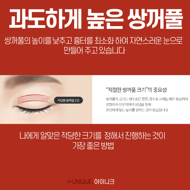 눈 재수술을 알아보고 있다면 압구정동성형외과 아이니크에서! 관련 이미지 3