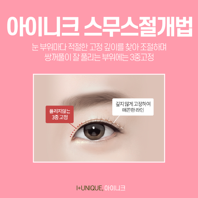 매몰쌍꺼풀 잘하는곳 풀리지않는곳ㅇㅇㄴㅋ 관련 이미지 4