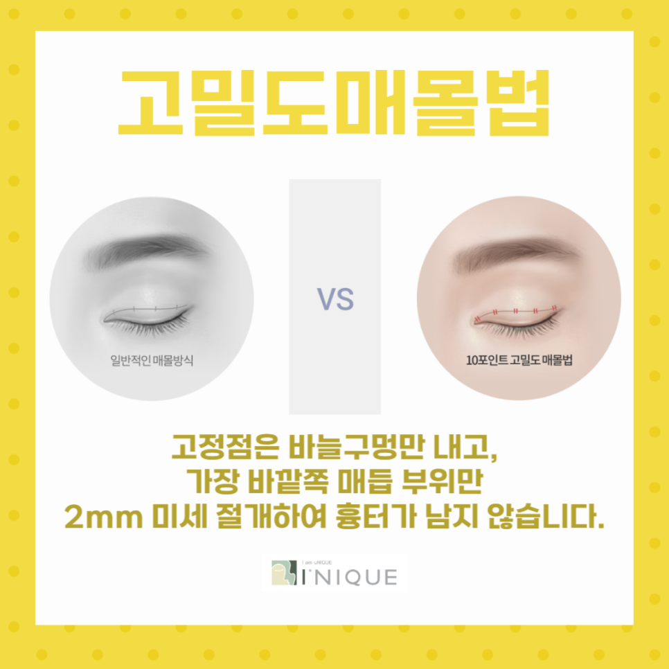 If you want to know where to find the best place for double eyelid surgery in Gangnam image 4