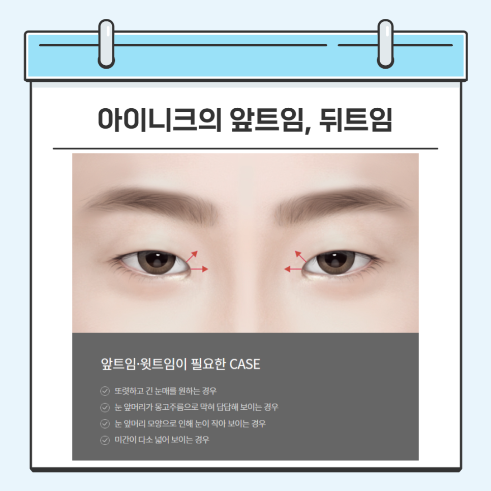 밑트임수술 안전하게 할 수 있는 방법 관련 이미지 4
