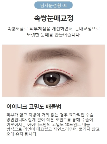 비절개눈매교정술 주의할 건 없을까? 관련 이미지 4