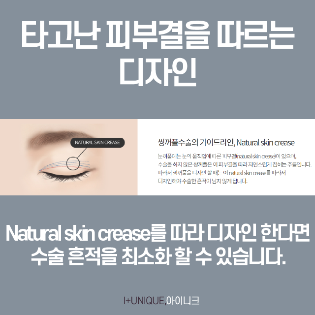 자연스러운 쌍수를 위해 꼭 알아야 하는 이것 관련 이미지 5