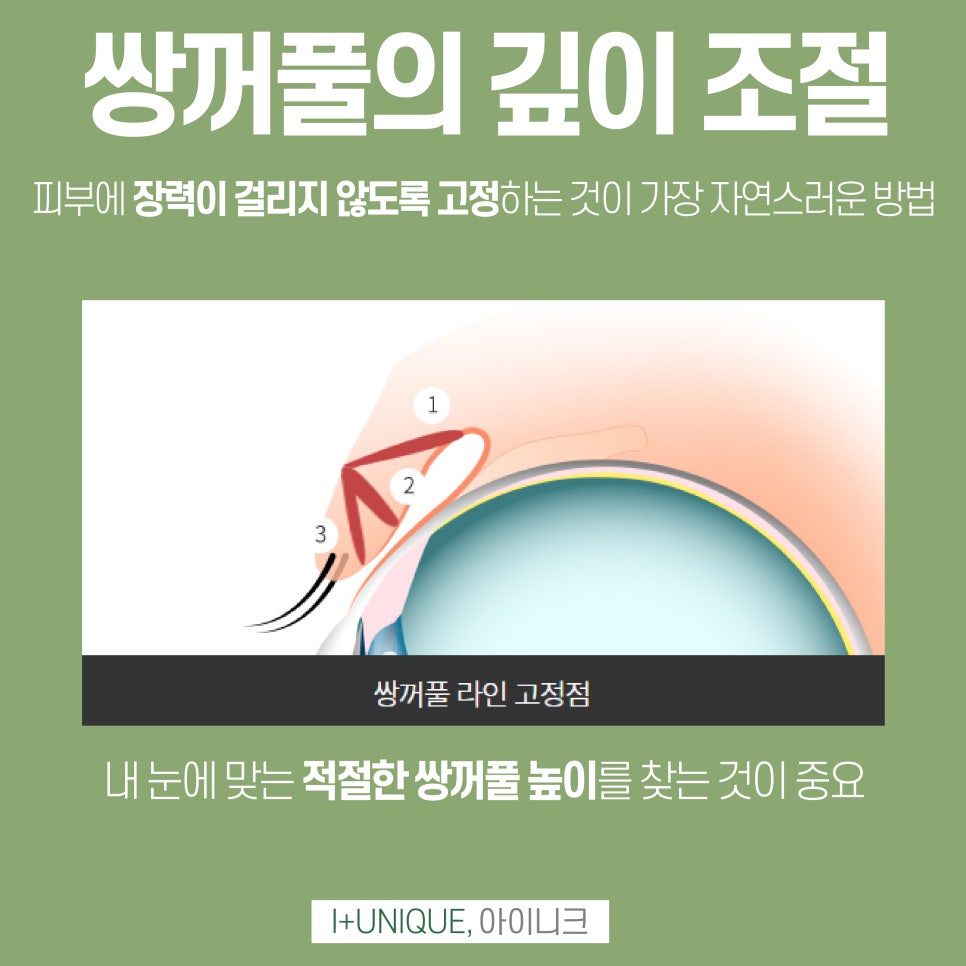 눈재수술유명한곳 어렵게 찾지말고 바로 아이니크성형외과에서 관련 이미지 4