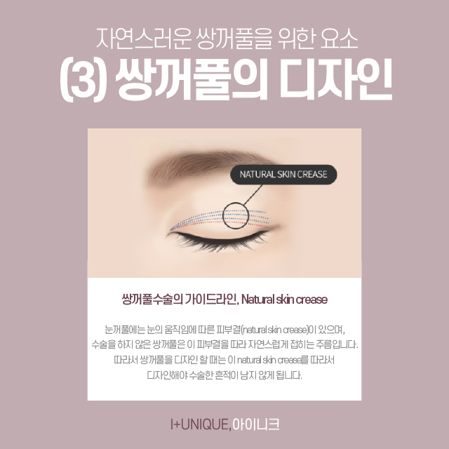 남자눈성형잘하는곳을 찾고 있다면? 관련 이미지 5