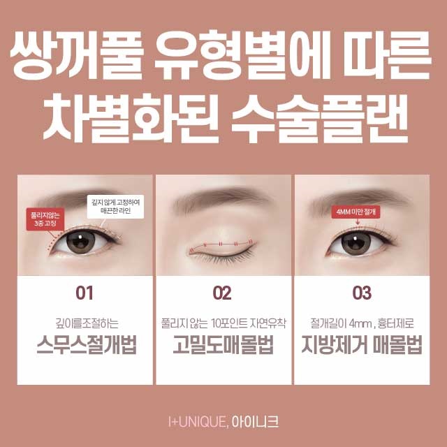 강남쌍꺼풀수술 믿을만 한 곳으로 선택하자! 관련 이미지 4