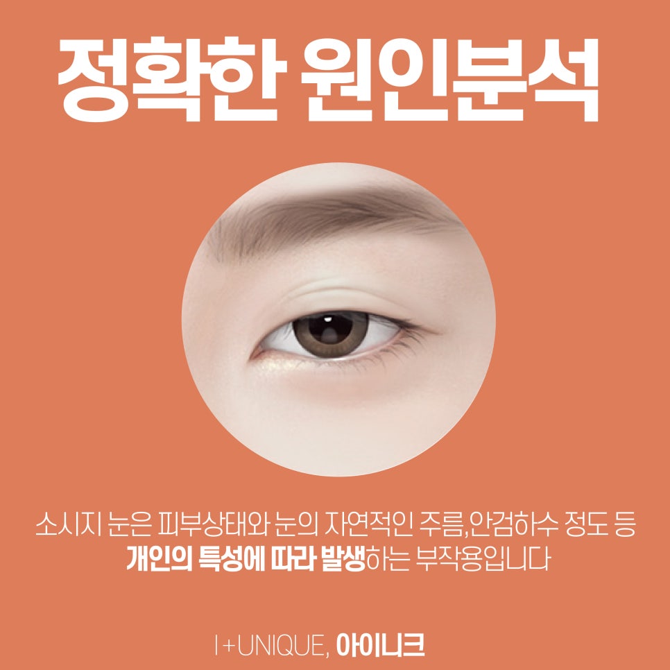 눈성형추천 아이니크성형외과에서 알려주는 수술방법 관련 이미지 5