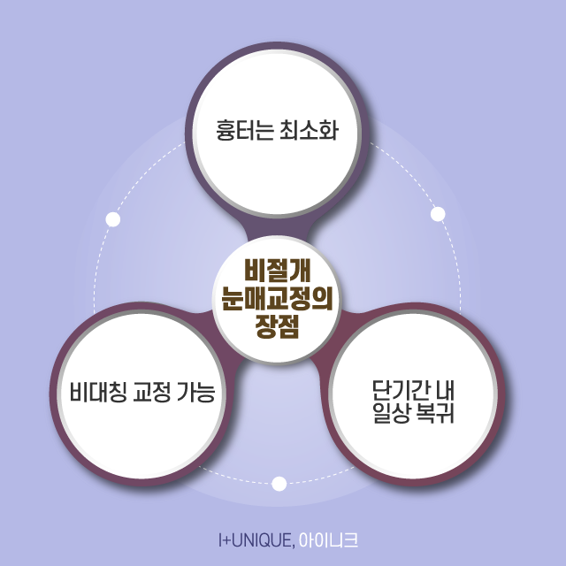 비절개눈매교정 수술로 첫인상 바꾸기 관련 이미지 5