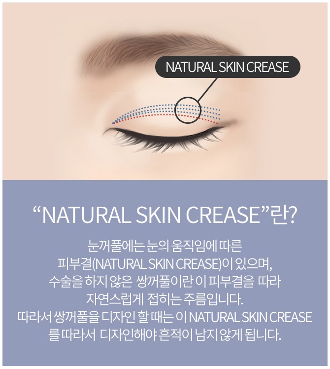 쌍꺼풀수술자국 걱정 없이 예쁘게! 관련 이미지 3
