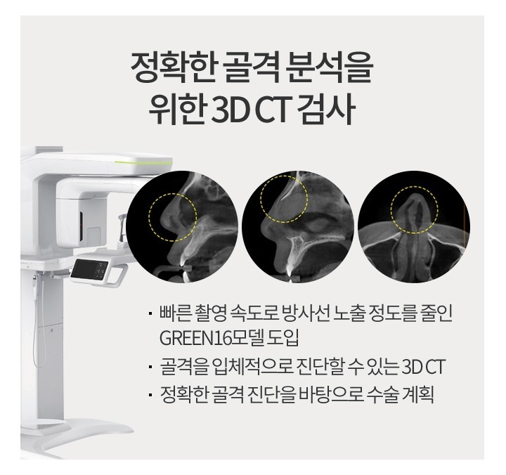 콧망울축소수술 이상적인 비율로 세련된 코 라인! 관련 이미지 5