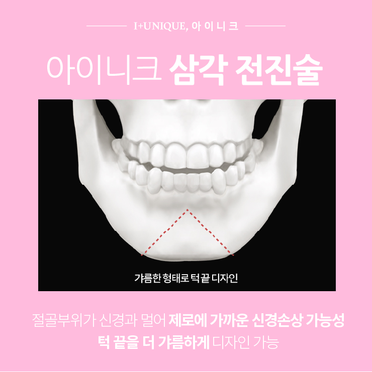 턱이 없다구요?! ㅇㅇㄴㅋ 무턱 3가지 해결방법 관련 이미지 5