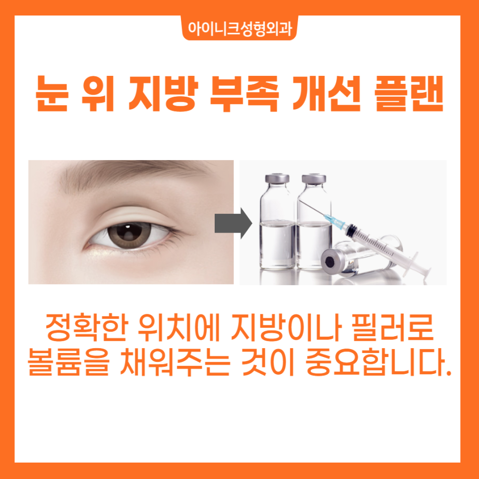 소시지눈해결방법으로 알아보는 확실한 재수술 관련 이미지 5