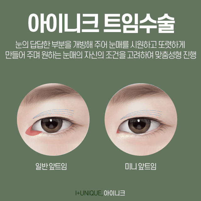 눈성형비용, 일단은 상담부터 받고 결정하자 관련 이미지 4