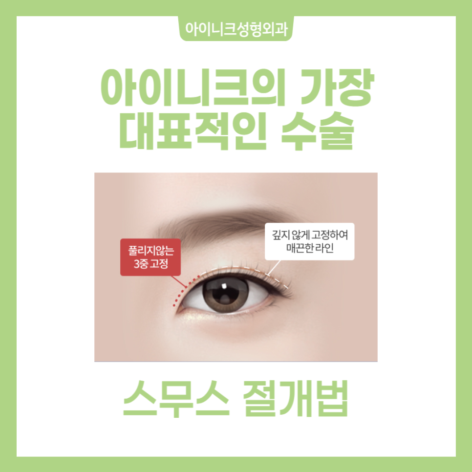 Gangnam Eyelid Surgery Recommendation: Where Is Safe and Reliable? image 4