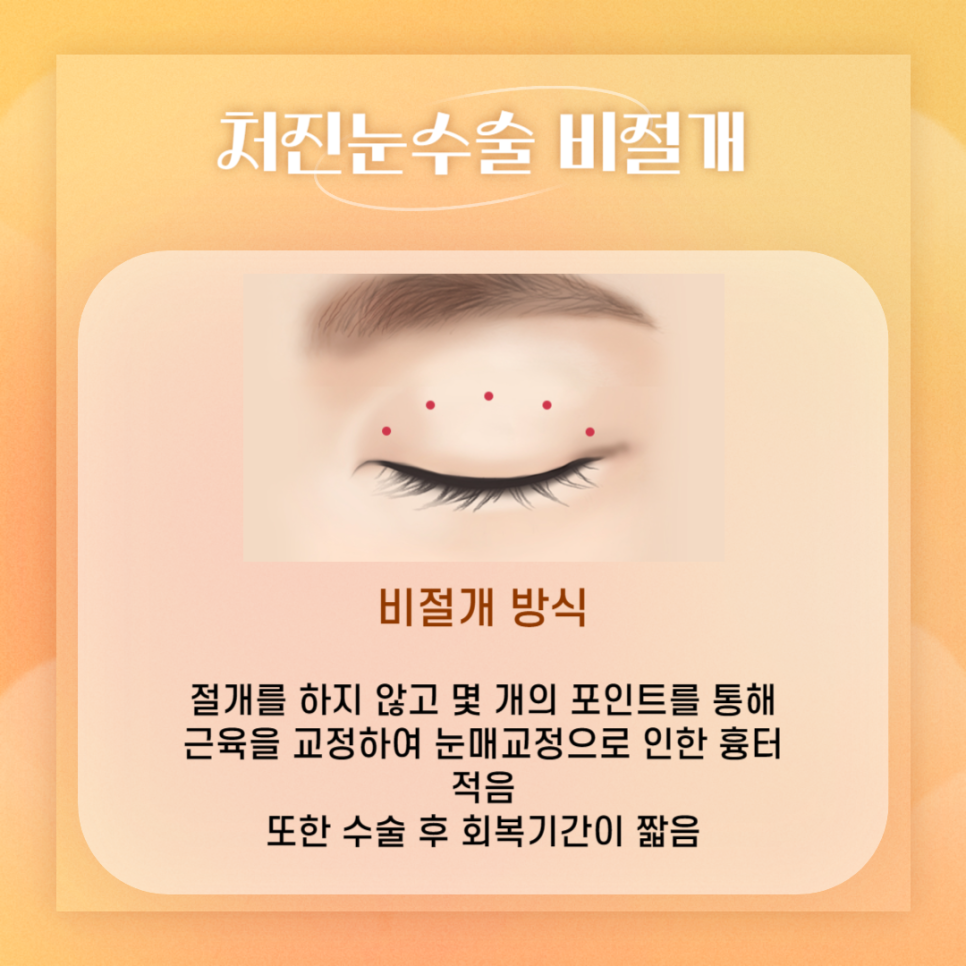 처진눈수술, 안전하고 회복이 빠른 아이니크 관련 이미지 5