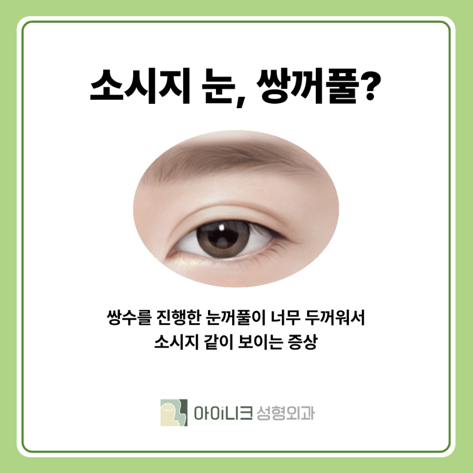 강남 쌍수재수술 필요한 경우와 꼼꼼함의 중요성 관련 이미지 9