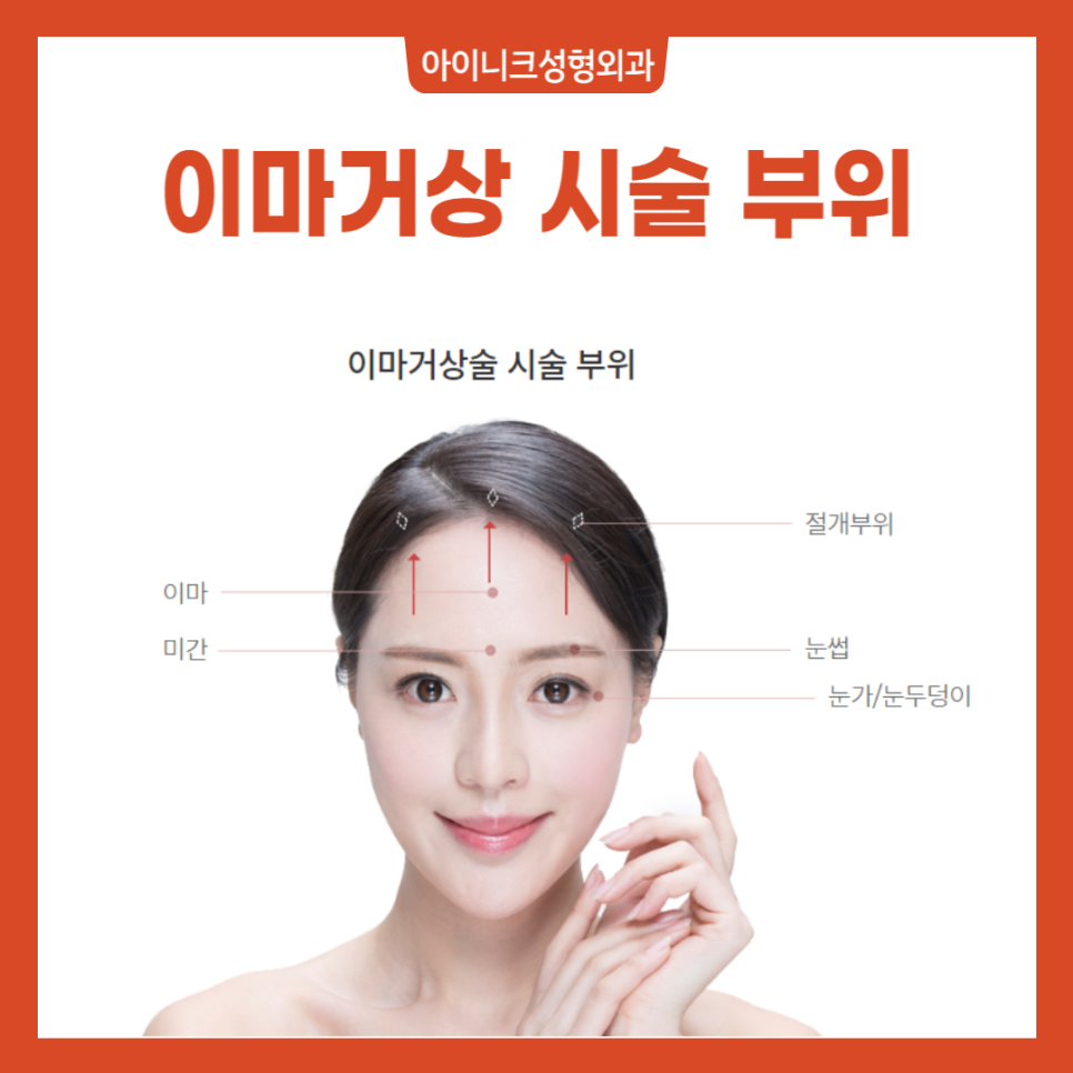이마주름수술, 탄력있게 변화해보세요! 관련 이미지 2