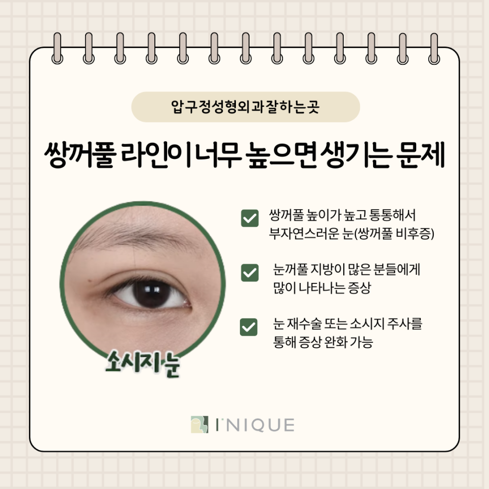 The Secret of Double Eyelid Height Revealed by a Best-Rated Apgujeong Plastic Surgery Clinic image 4