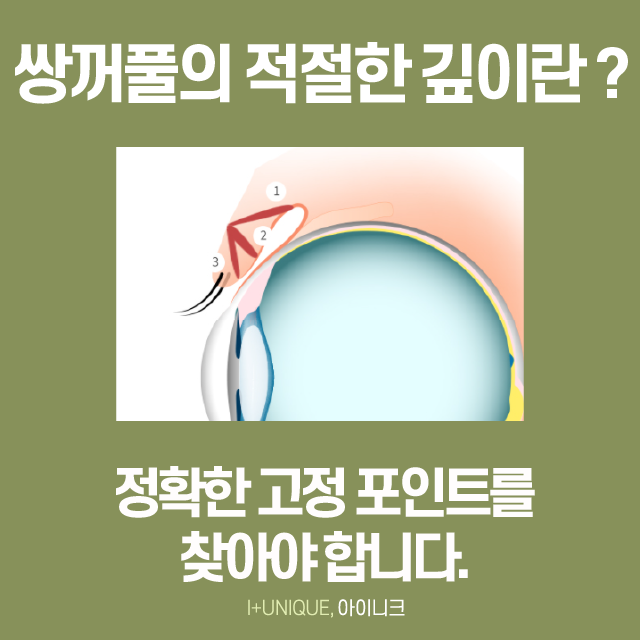 서울에서 쌍꺼풀수술을 가장 잘하는 곳을 찾고 있다면? 클릭! 관련 이미지 4