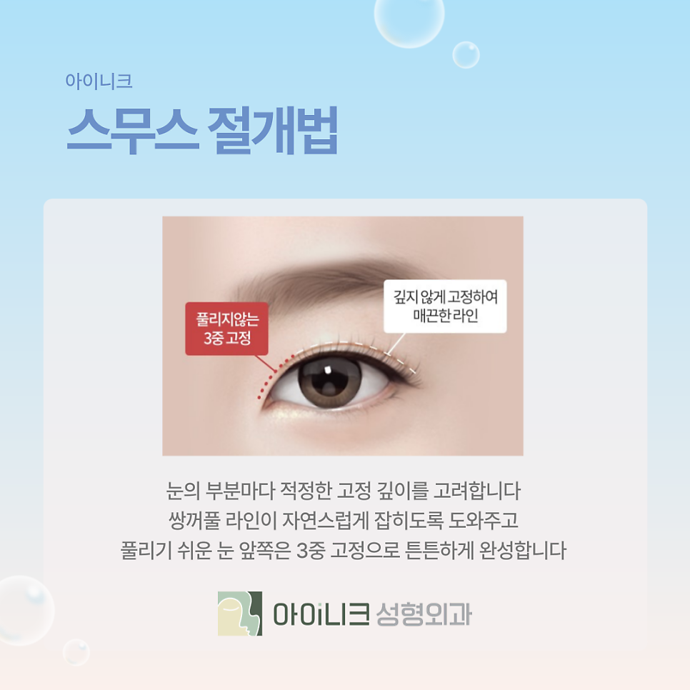 쌍꺼풀성형외과 흉터가 남을까 걱정된다면? 관련 이미지 13