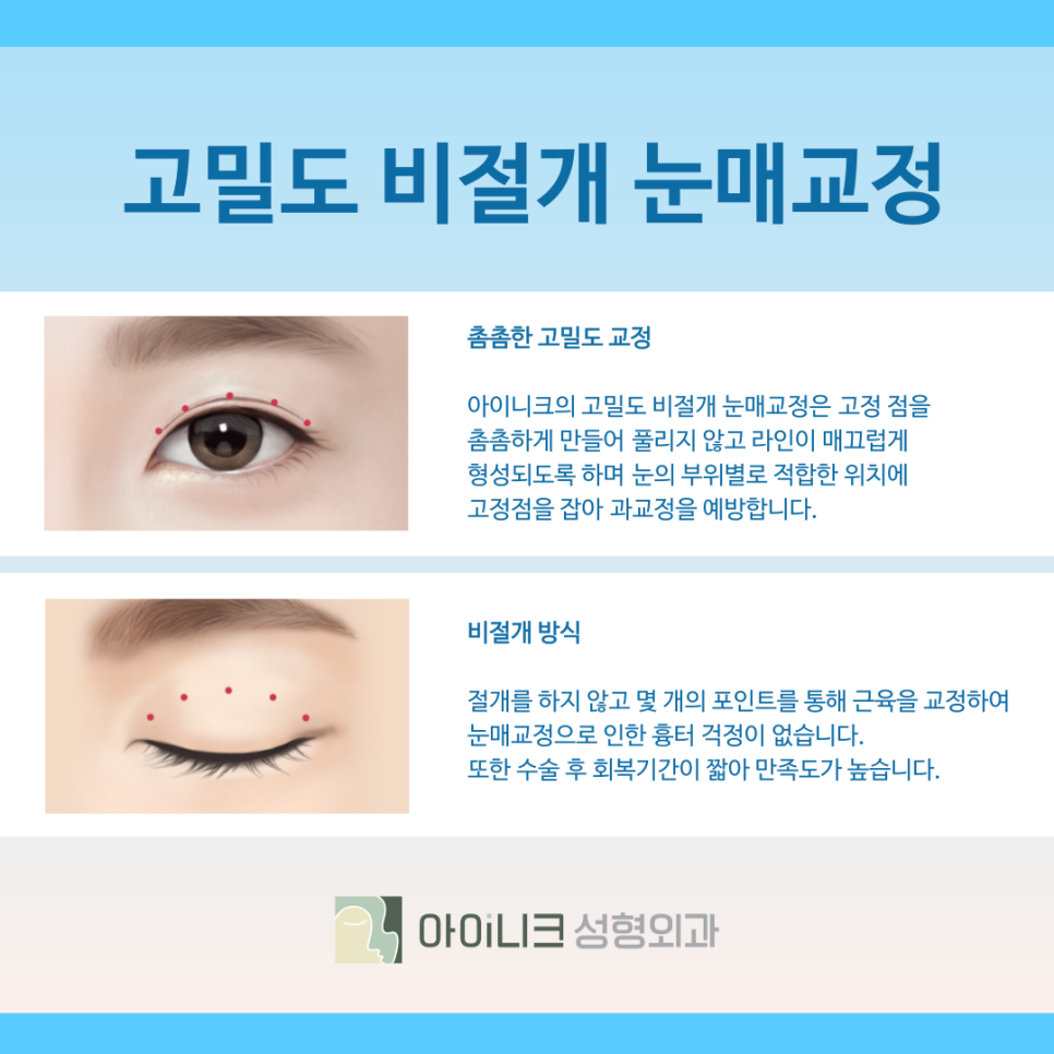 How to Improve Droopy Eyes with Ptosis Surgery in Seoul image 7