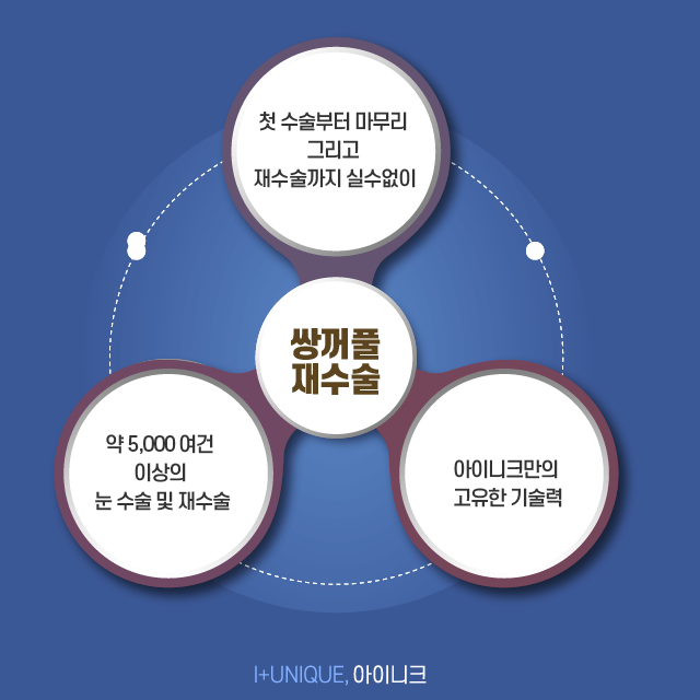 통통해서 부담스러운 내 눈, 쌍꺼풀라인낮추기로 처음부터 내 눈이였던 것처럼 관련 이미지 6