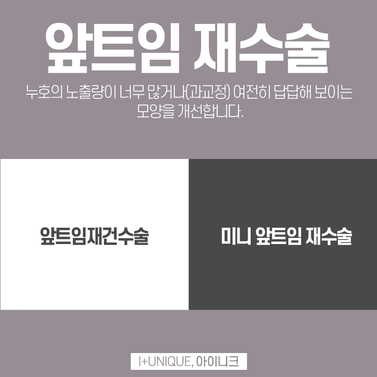 아이니크성형외과에서 트임재수술로 다시 또렷하게 관련 이미지 2