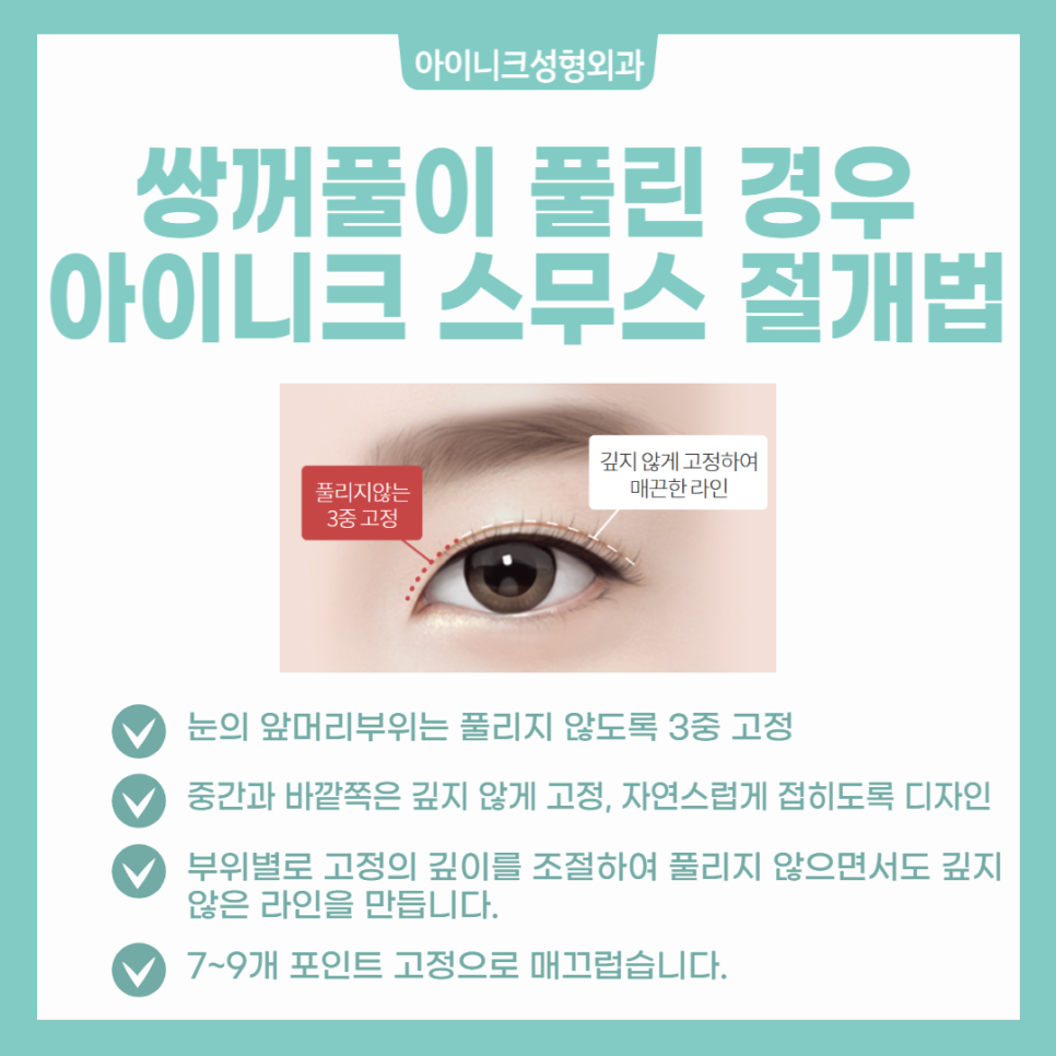 쌍꺼풀 여러겹 해결할 수 있을까? 관련 이미지 4