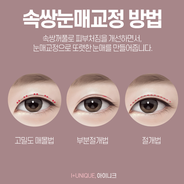 남자눈성형외과 알아보고 있다면 경력과 노하우가 있는 곳으로 관련 이미지 3