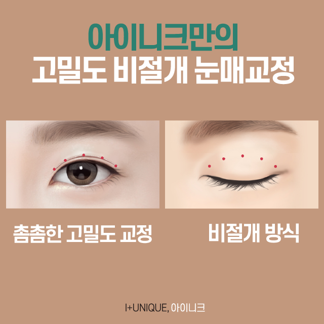 비절개눈매교정 꼼꼼하게 병원을 선택해야 하는 이유 관련 이미지 4