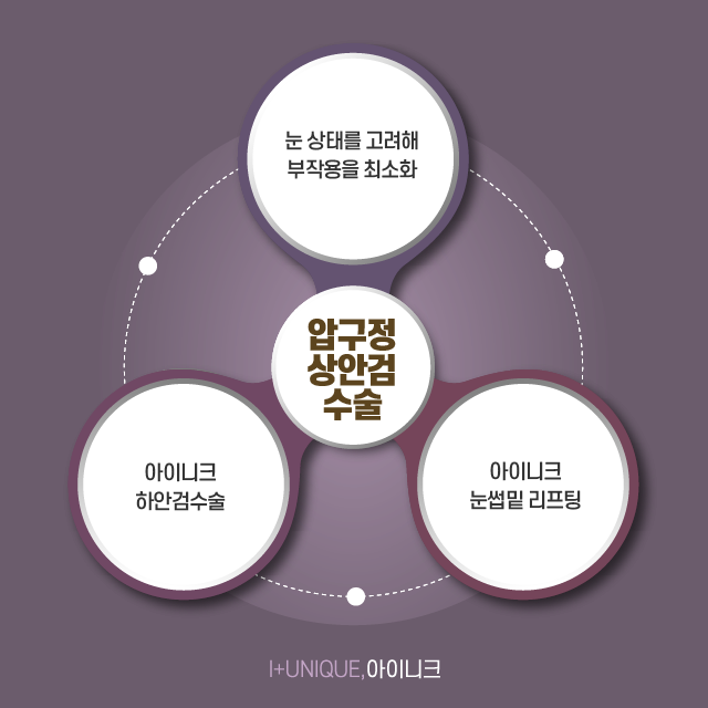 압구정 상안검수술 눈꺼풀이 늘어진 분이라면 주목 관련 이미지 6