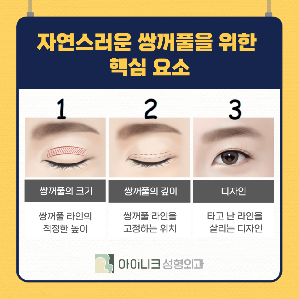 쌍수잘하는병원 실패없이 잘 선택하려면 관련 이미지 9