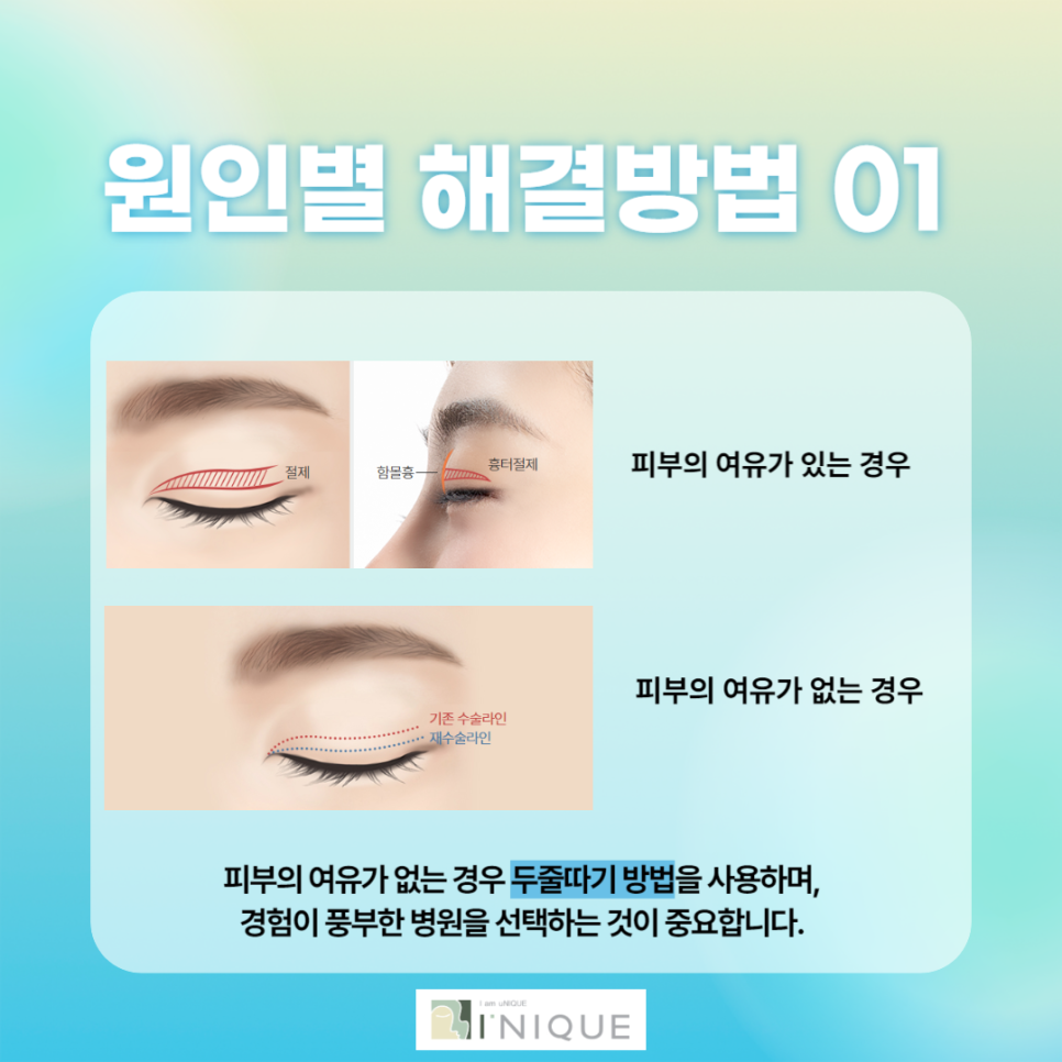 소시지눈 어떻게 하면 해결할 수 있을까? 관련 이미지 3