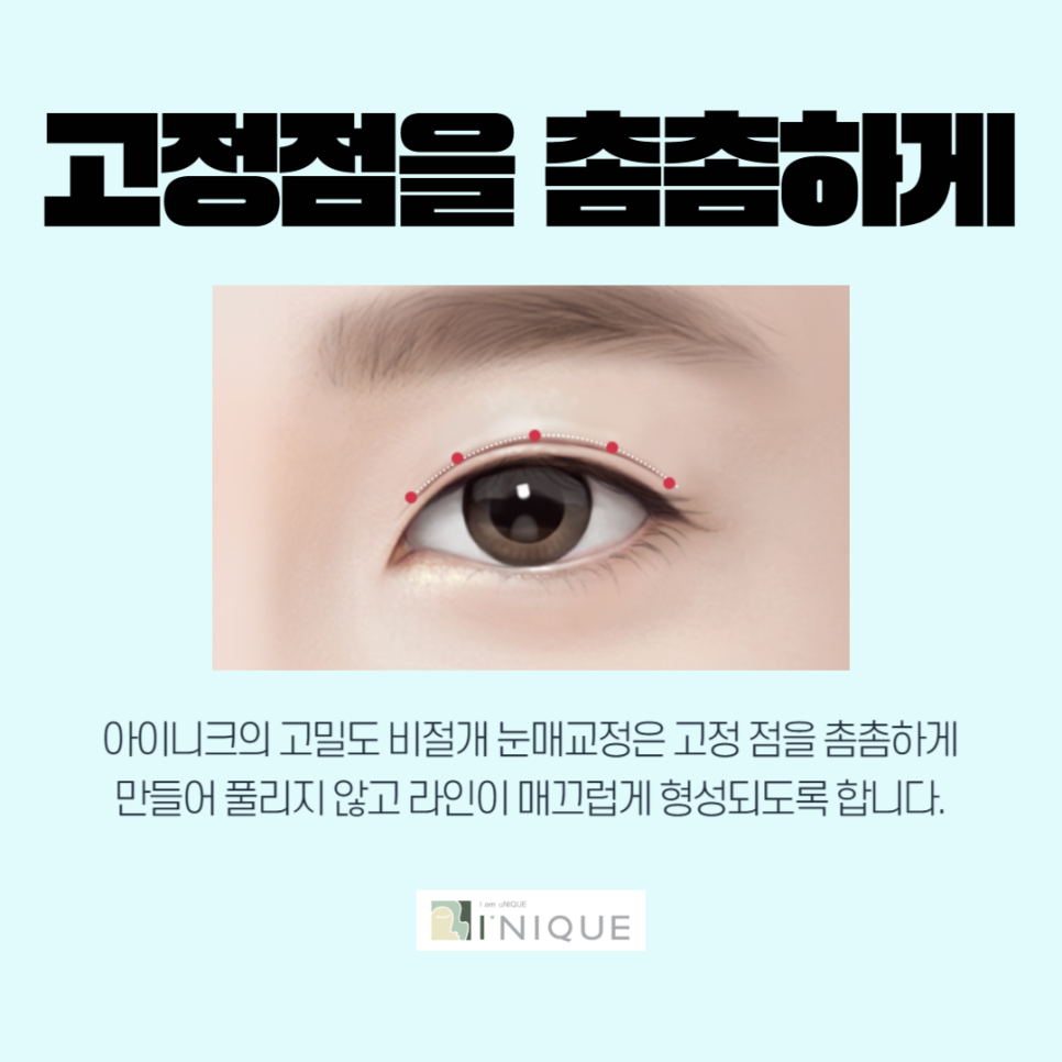 Drooping Eyelid Procedure, with Accurate Diagnosis and Safe Treatment image 5