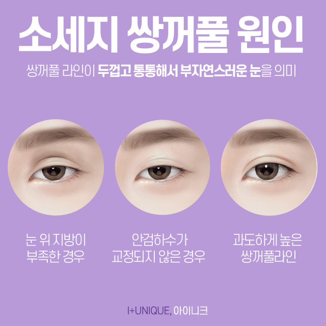 쌍꺼풀제수술잘하는곳을 찾는다면 아이니크만한 곳이 없죠 관련 이미지 3