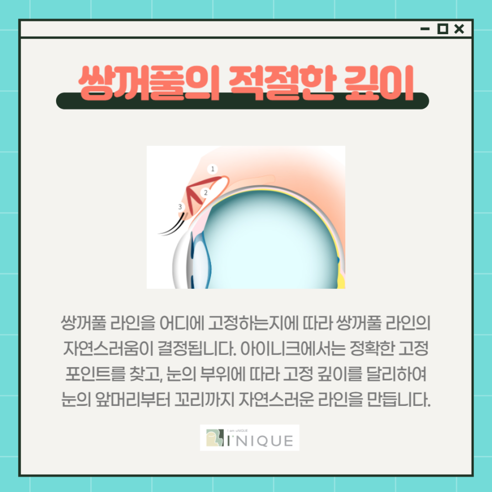 Ineek Buried Suture Method, Even More Secure and Smooth! image 5