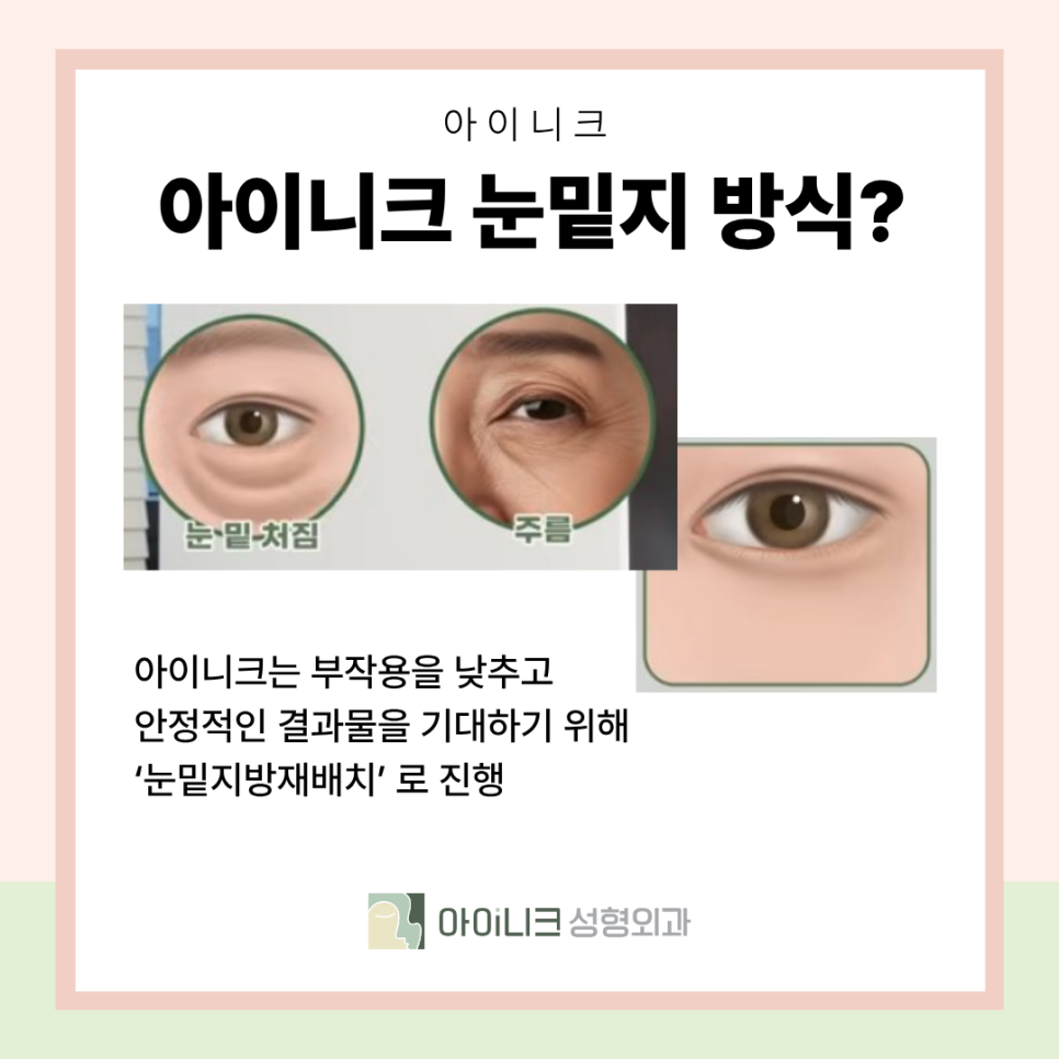 앙코르 눈밑지 비교 일반 방식과의 차이 수술 방법 관련 이미지 5