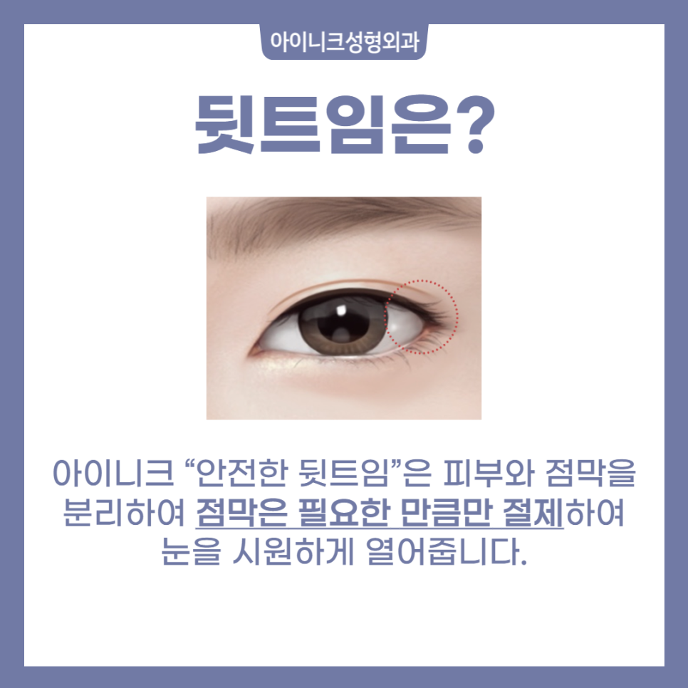 Full Eye Corners, Various Types! image 6