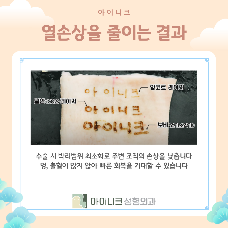 눈밑지방재배치가격만 중요할까? 관련 이미지 11
