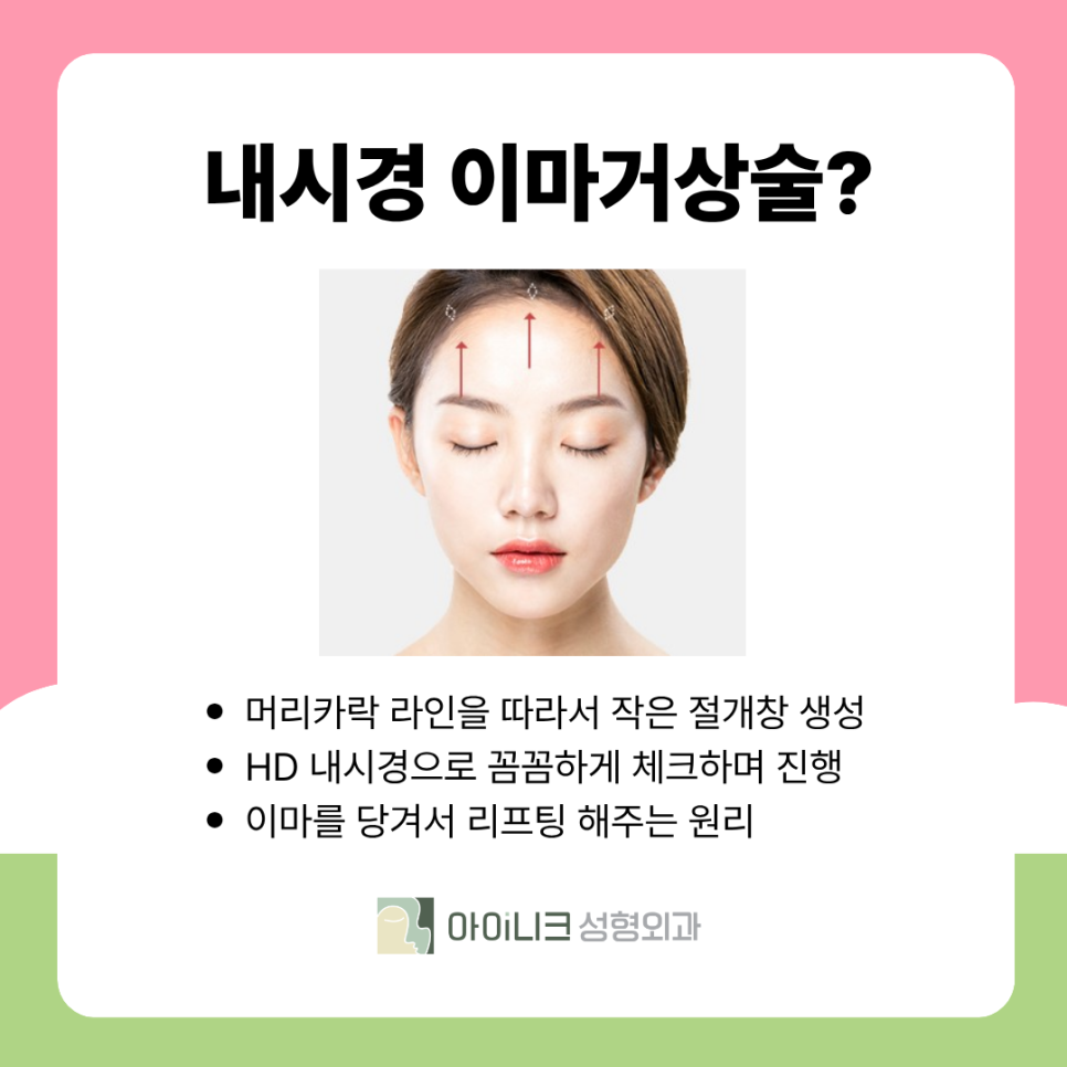 How Endoscopic Forehead Lift Surgery Is Performed and Its Expected Effects image 4