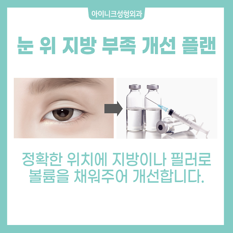 눈재수술성형외과에서 소시지 눈 고민 해결! 관련 이미지 5