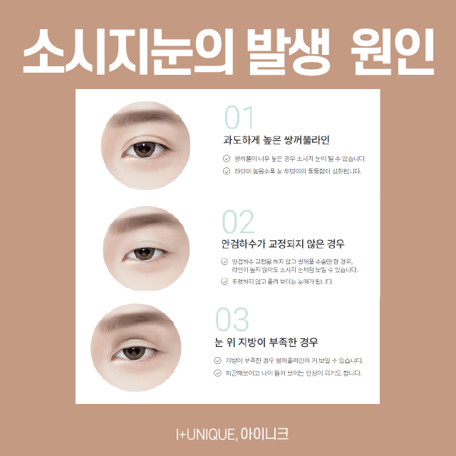 소시지눈주사추천, 눈 성형 전문병원에서! 관련 이미지 2