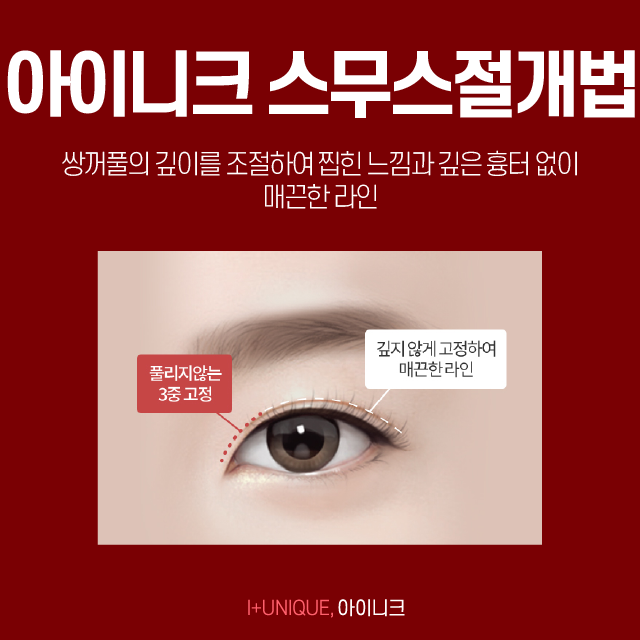 쌍꺼풀잘하는곳 여기로 결정하자! 관련 이미지 3