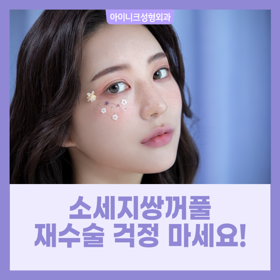 소세지쌍꺼풀 재수술 걱정 마세요! 관련 이미지 1
