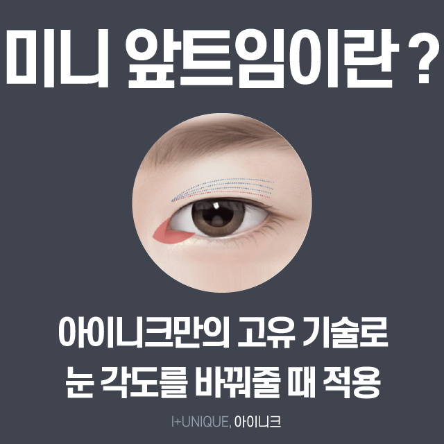 트임 성형 잘하는곳 검색하느라 지치셨죠? 아이니크로 오세요~ 관련 이미지 3