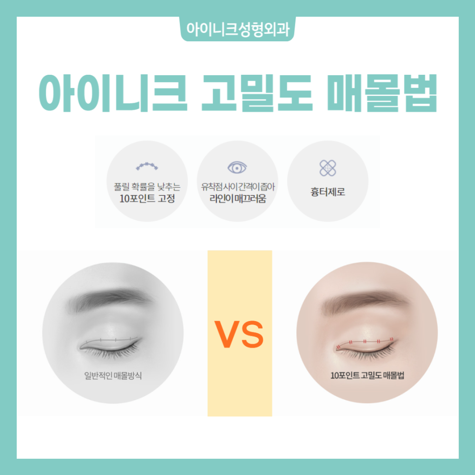 쌍꺼풀만들기 아이니크에서 알아보세요! 관련 이미지 4