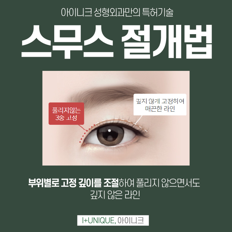 압구정눈재수술병원 방황하지 말고 아이니크성형외과에서 관련 이미지 3