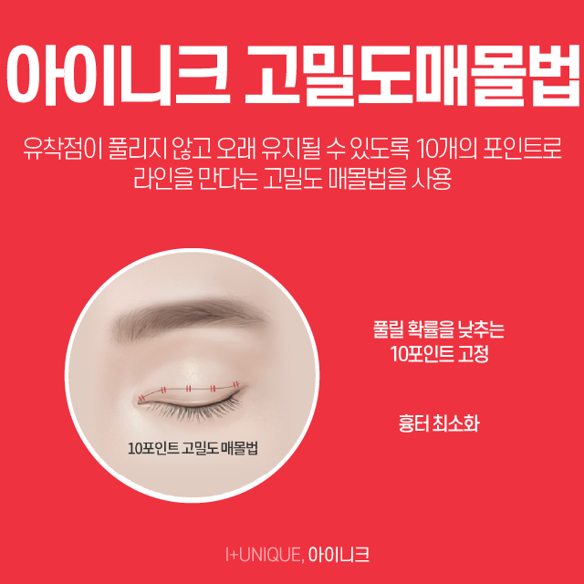 쌍수병원추천 수술의 종류를 알면 실력이 보인다! 관련 이미지 4